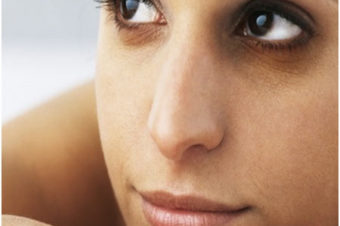 8 Causes Of Dark Circles You Should Be Aware Of