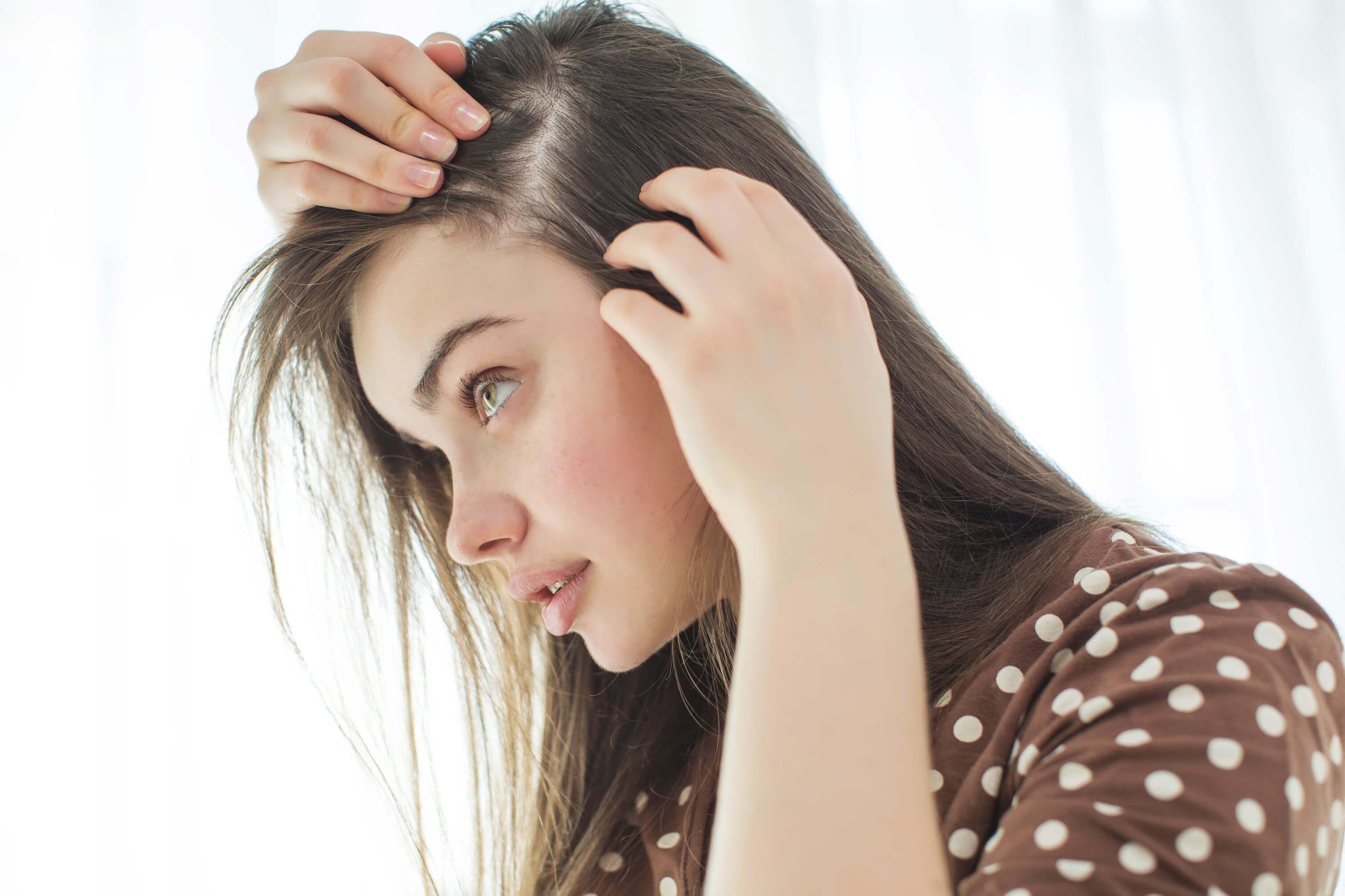 Волосы сильно выпадают анализы сдать. Сильное выпадение волос. Выпадение волос у женщин.