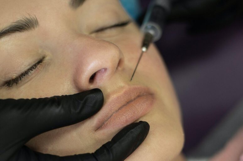 THINGS YOU SHOULD KNOW ABOUT MICRONEEDLING